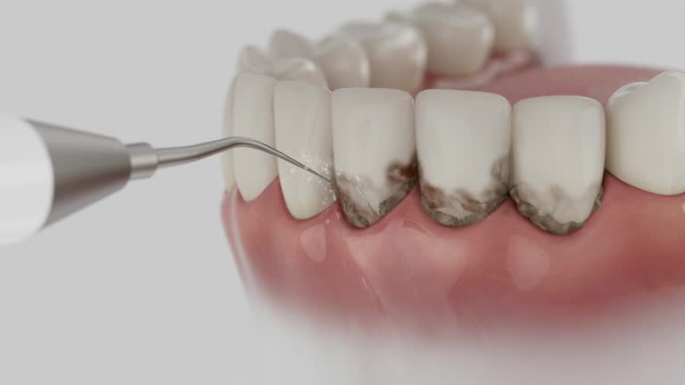 Trusted Dental Crowns And Bridges service in Venersborg, WA - Dentist Open Now